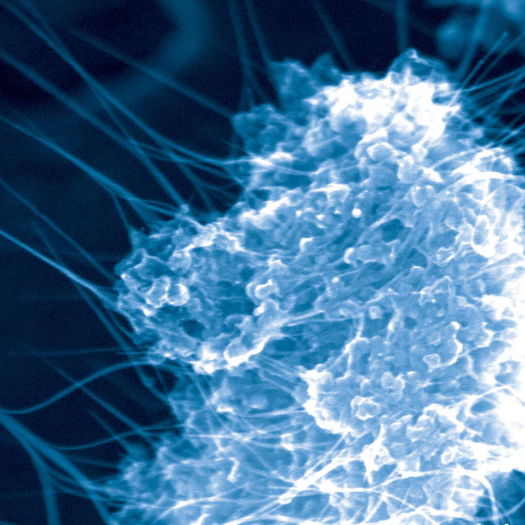 A microscopic view of a cancer cell