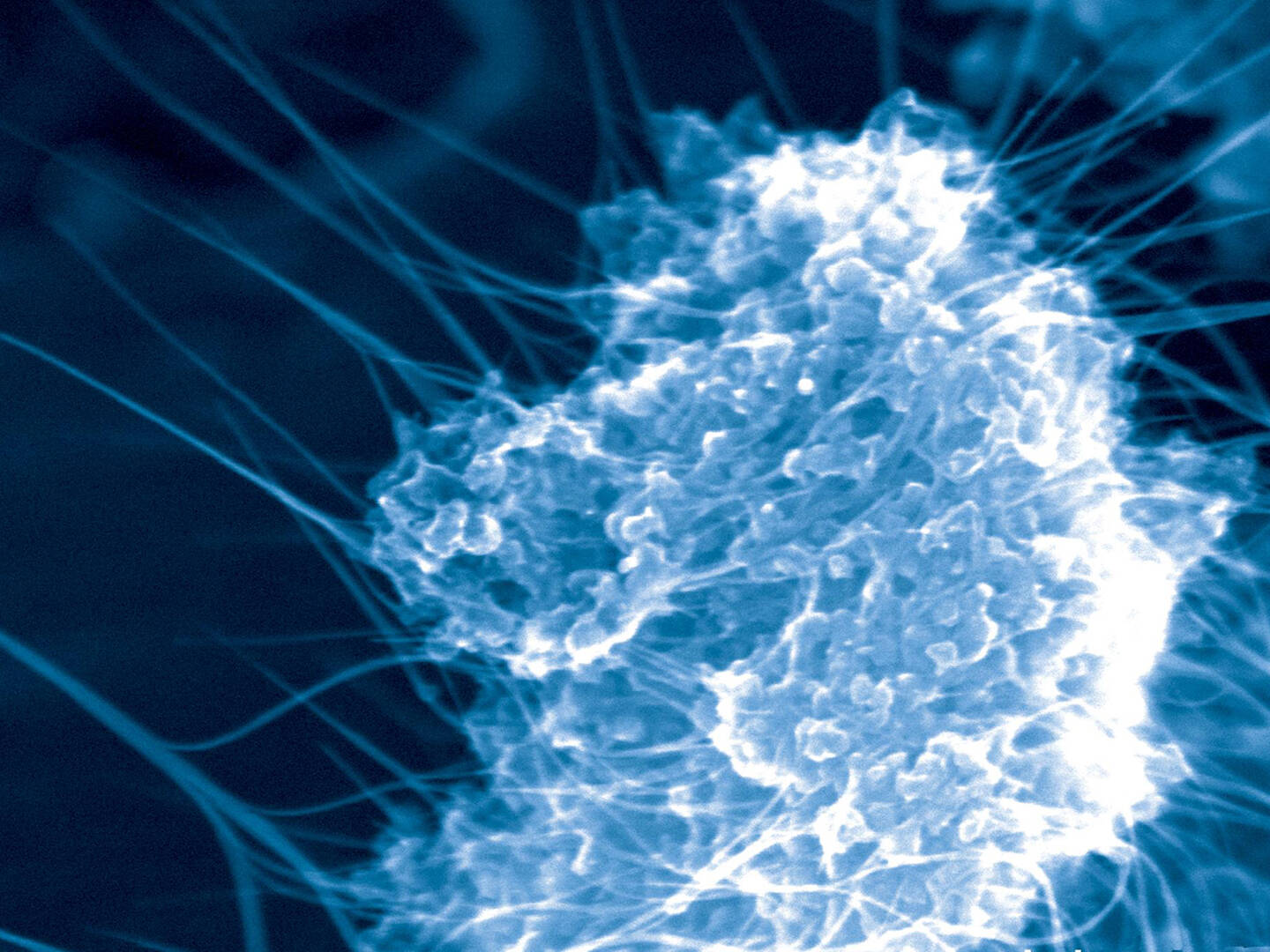 A microscopic view of a cancer cell