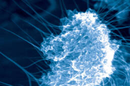 A microscopic view of a cancer cell