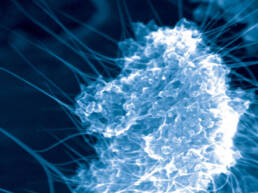 A microscopic view of a cancer cell