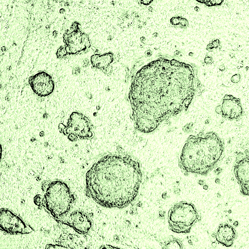 A microscopic view of green cells