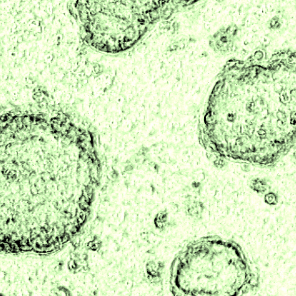 A microscopic view of green cells