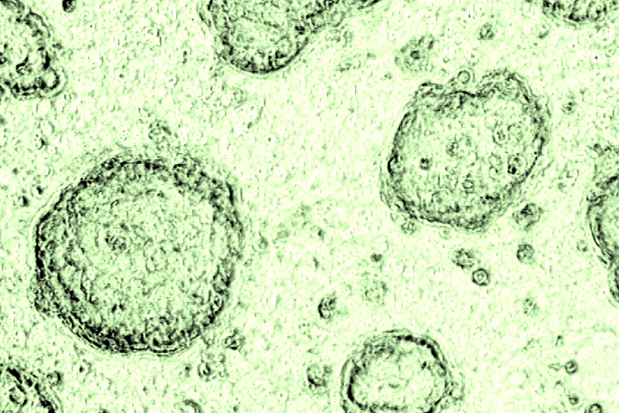 A microscopic view of green cells