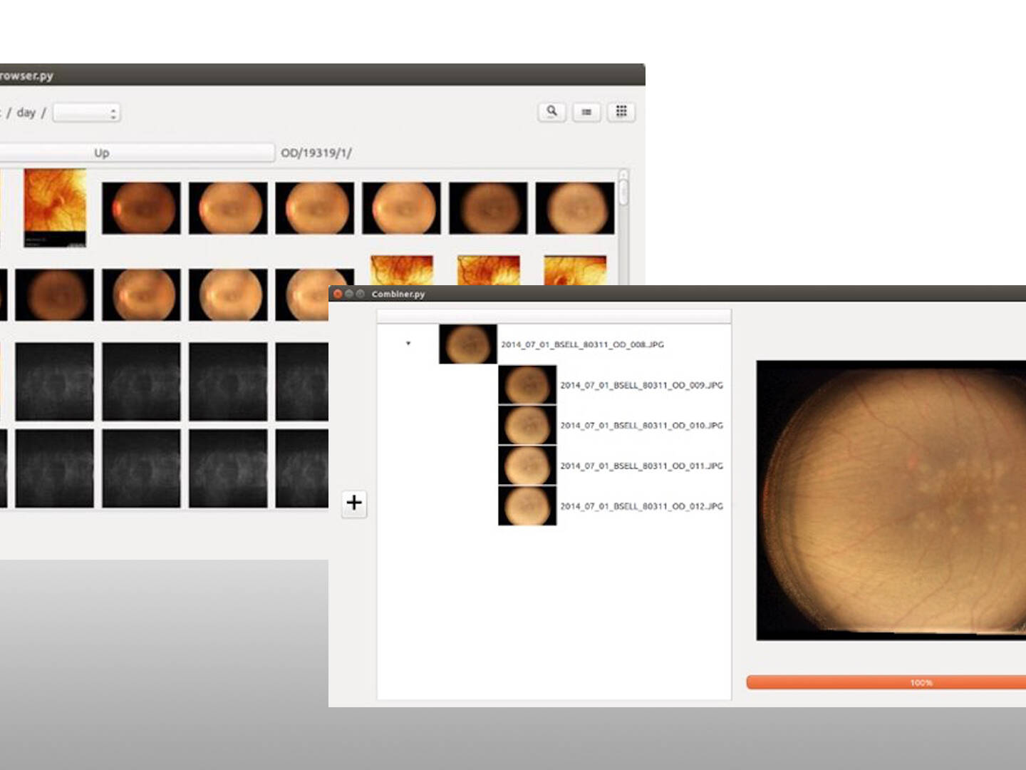 Two computer screenshots of a retina software program