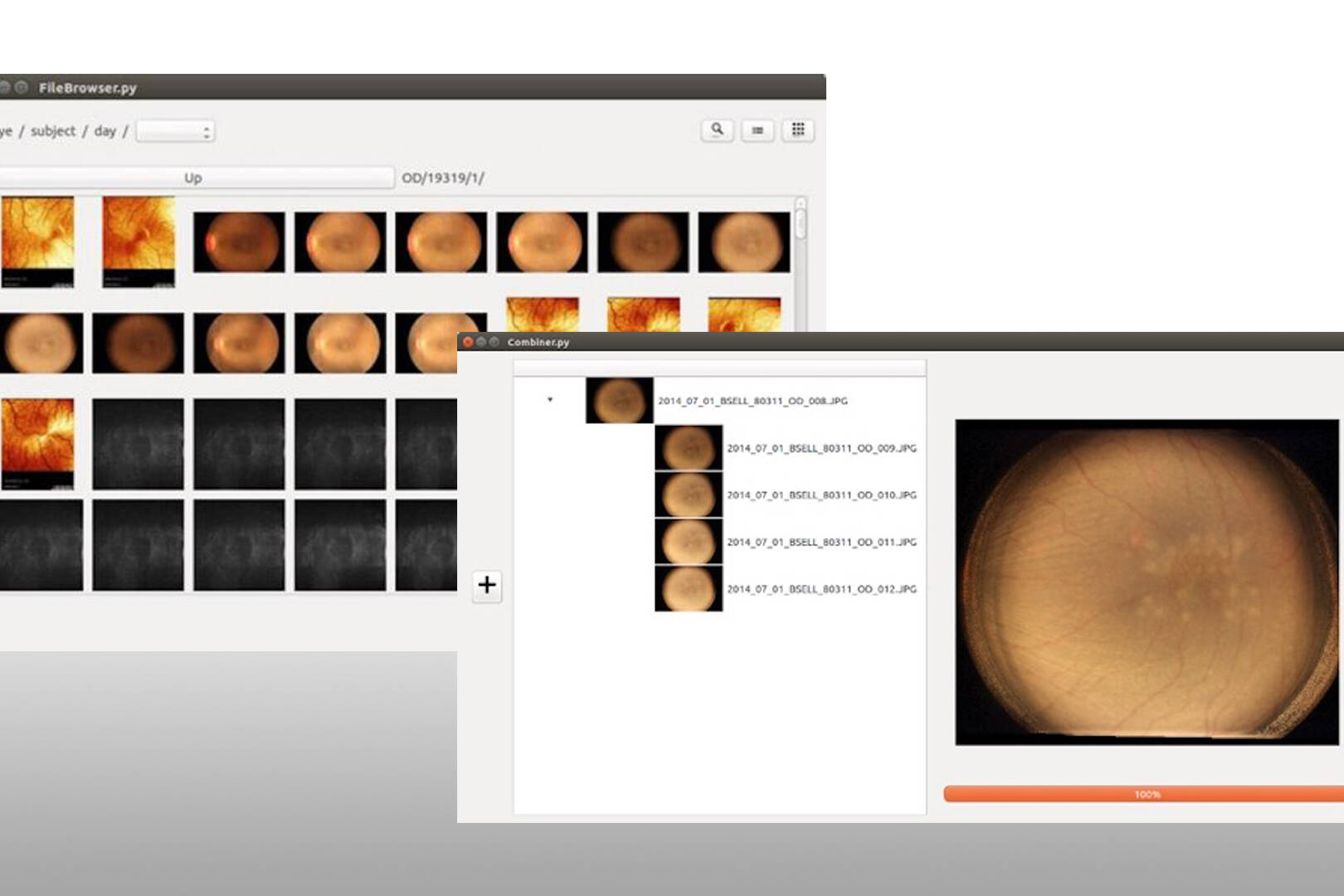 Two computer screenshots of a retina software program