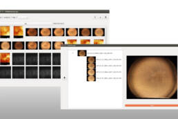 Two computer screenshots of a retina software program